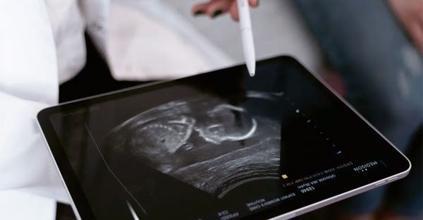 Ce factori ar influența dezvoltarea cerebrală a copilului încă din sarcină